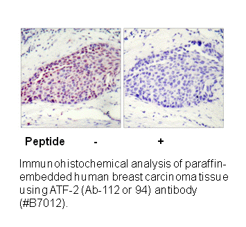 Product image for ATF2 (Ab-112 or 94) Antibody