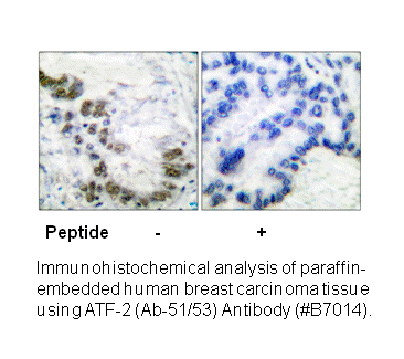 Product image for ATF2 (Ab-69 or 51) Antibody