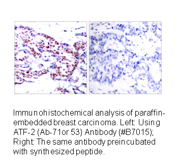 Product image for ATF2 (Ab-71 or 53) Antibody