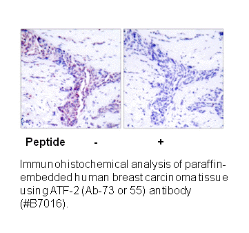 Product image for ATF2 (Ab-73 or 55) Antibody