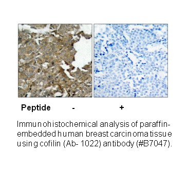 Product image for Cofilin (Ab-3) Antibody