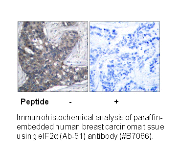 Product image for eIF2&alpha; (Ab-51) Antibody