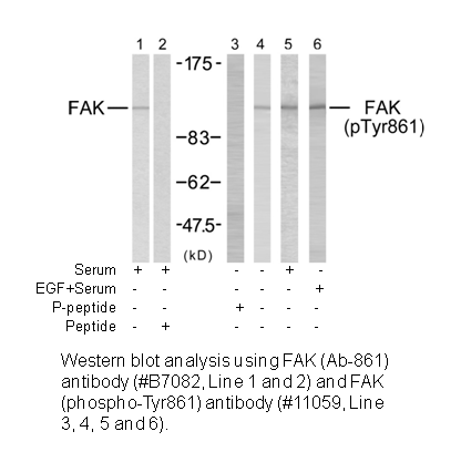 Product image for FAK (Ab-861) Antibody