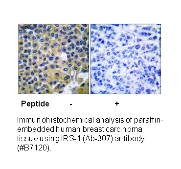 Product image for IRS-1 (Ab-307) Antibody