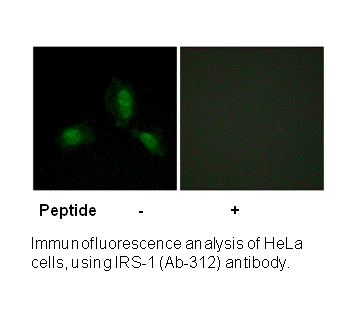 Product image for IRS-1 (Ab-312) Antibody