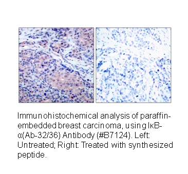 Product image for I&kappa;B-&alpha; (Ab-32/36) Antibody