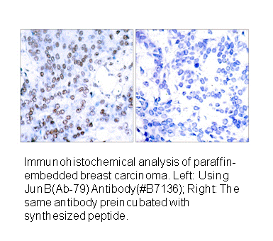 Product image for JunB (Ab-79) Antibody