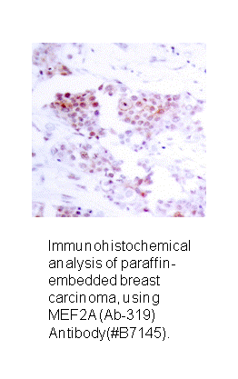 Product image for MEF2A (Ab-319) Antibody