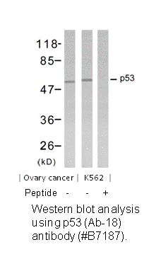 Product image for p53 (Ab-18) Antibody