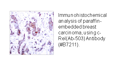 Product image for Rel (Ab-503) Antibody