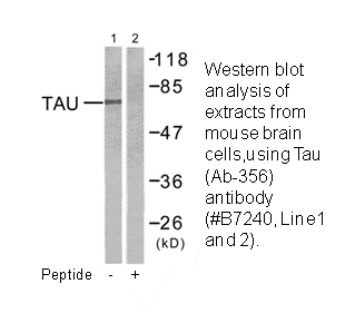 Product image for Tau (Ab-356) Antibody