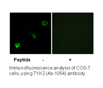 Product image for TYK2 (Ab-1054) Antibody