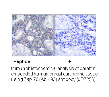 Product image for ZAP-70 (Ab-493) Antibody