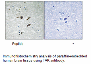 Product image for FAK (Ab-577) Antibody