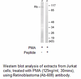 Product image for Retinoblastoma (Ab-608) Antibody