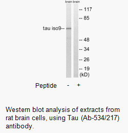 Product image for Tau (Ab-534/217) Antibody