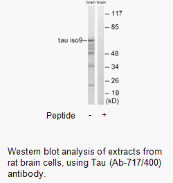 Product image for Tau (Ab-717/400) Antibody