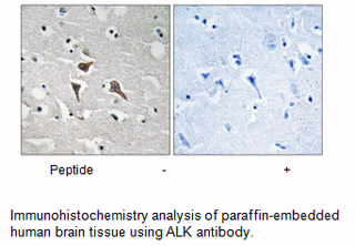 Product image for ALK (Ab-1096) Antibody