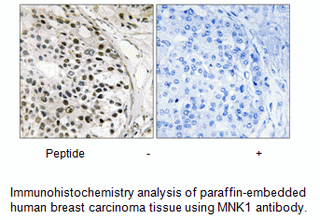 Product image for MNK1 (Ab-250) Antibody