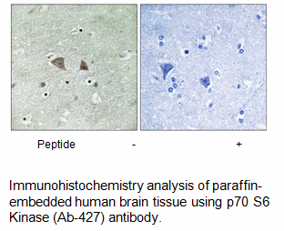 Product image for p70 S6 Kinase (Ab-427) Antibody