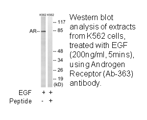 Product image for Androgen Receptor (Ab-363) Antibody