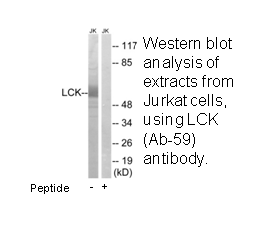 Product image for LCK (Ab-59) Antibody