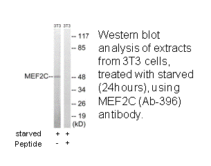 Product image for MEF2C (Ab-396) Antibody