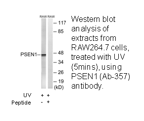 Product image for PSEN1 (Ab-357) Antibody