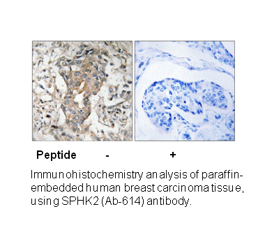 Product image for SPHK2 (Ab-614) Antibody