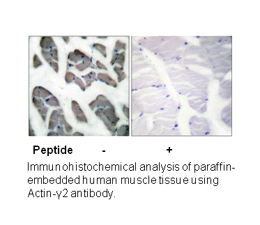 Product image for Actin-&gamma;2 Antibody