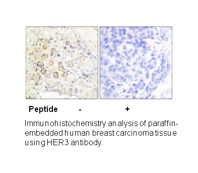 Product image for HER3 Antibody