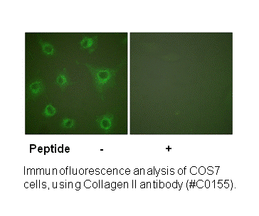 Product image for Collagen II Antibody