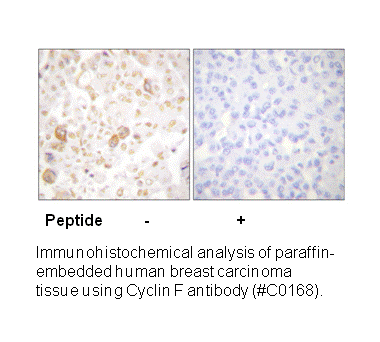 Product image for Cyclin F Antibody