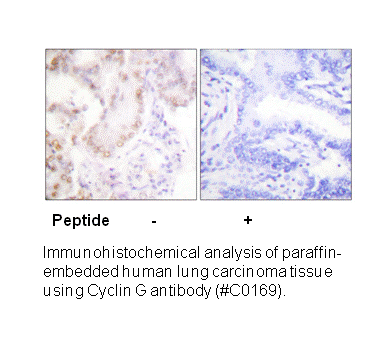 Product image for Cyclin G Antibody