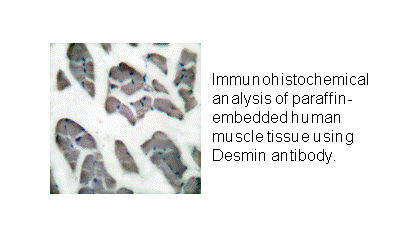 Product image for Desmin Antibody