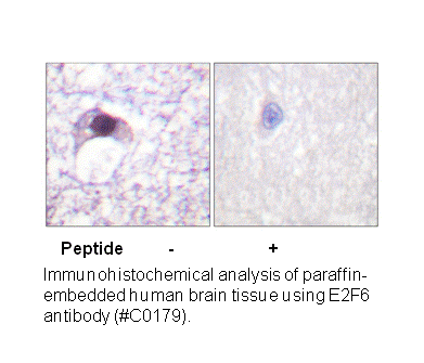 Product image for E2F6 Antibody