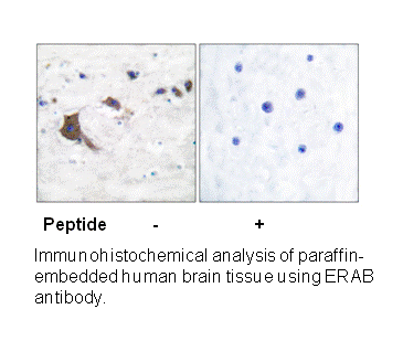 Product image for ERAB Antibody