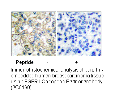 Product image for FGFR1 Oncogene Partner Antibody