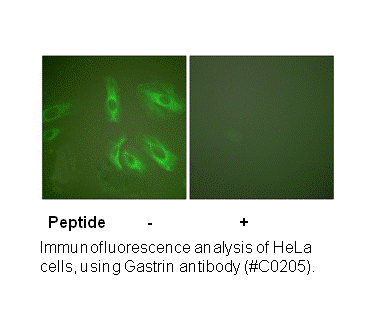 Product image for Gastrin Antibody