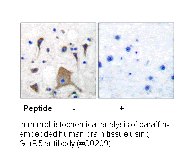 Product image for GluR5 Antibody