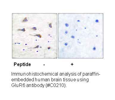 Product image for mGluR6 Antibody