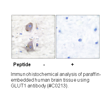 Product image for GLUT1 Antibody