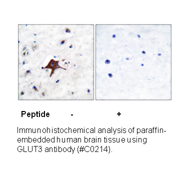 Product image for GLUT3 Antibody