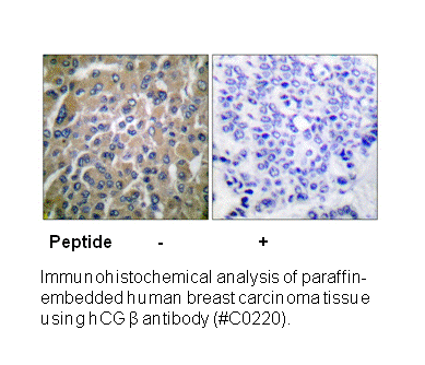 Product image for hCG &beta; Antibody