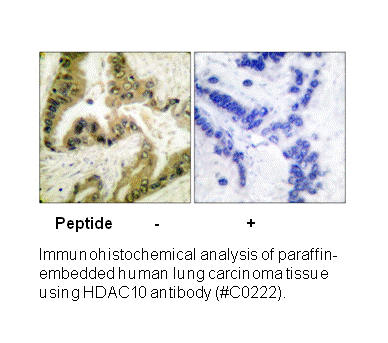 Product image for HDAC10 Antibody