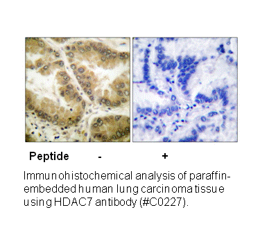 Product image for HDAC7 Antibody