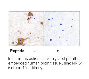 Product image for Heregulin Antibody