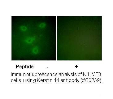 Product image for Keratin 14 Antibody