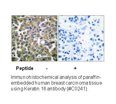 Product image for Keratin 16 Antibody