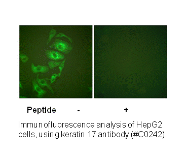 Product image for Keratin 17 Antibody